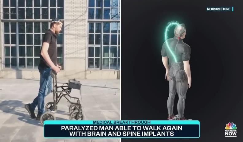 Импланты возвращают способность ходить
